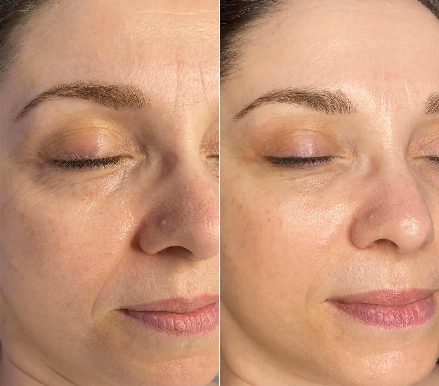 Glattes Gesicht nach Behandlung