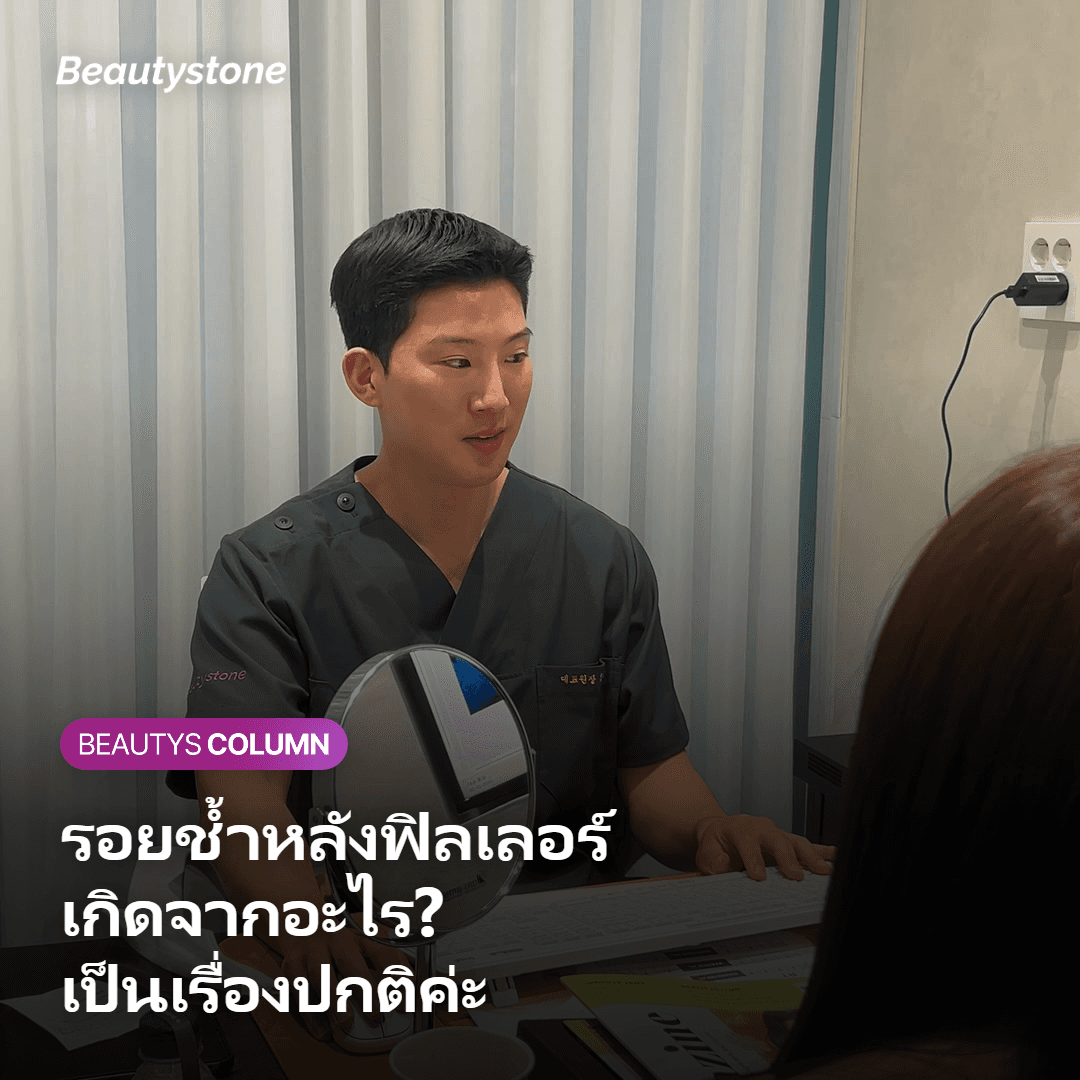 สาเหตุที่เกิดรอยช้ำและอาการบวมหลังฉีดฟิลเลอร์