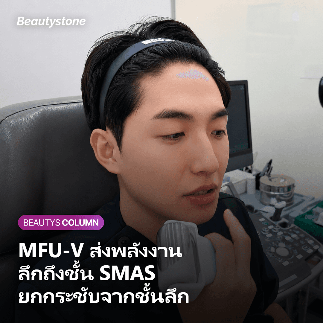 หลักการทำงาน Ultherapy Prime ส่งพลังงานลึกถึงชั้น SMAS