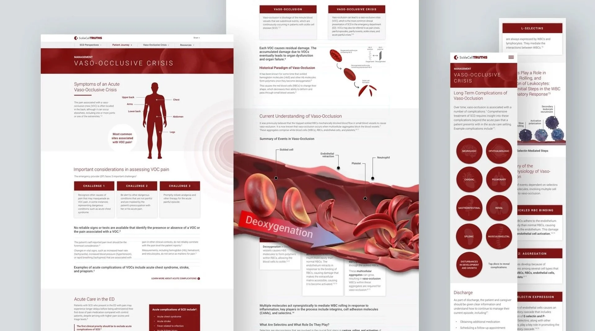 SCDTruths educational platform on desktop and mobile: vaso-occlusive crisis content.