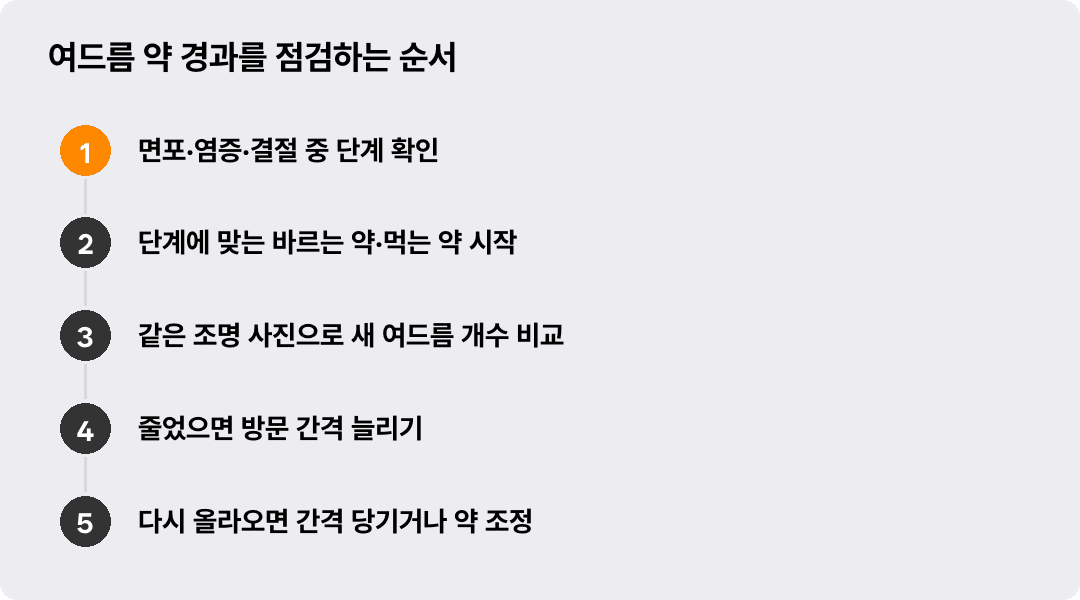 여드름 약 경과를 점검하는 순서