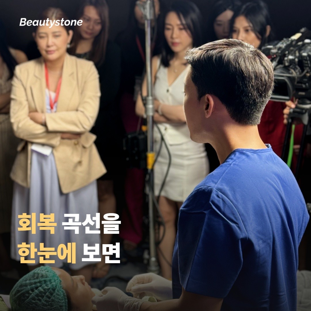 회복 곡선을 한눈에 보면 이래요