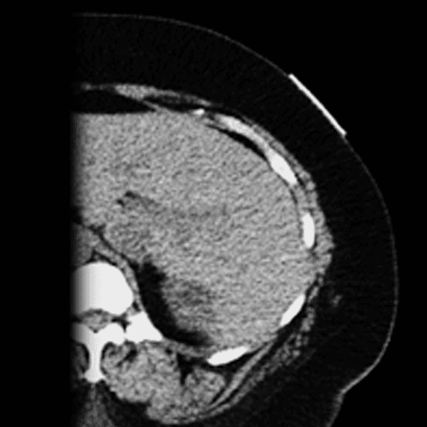 CT-SPOT REF 118 xray