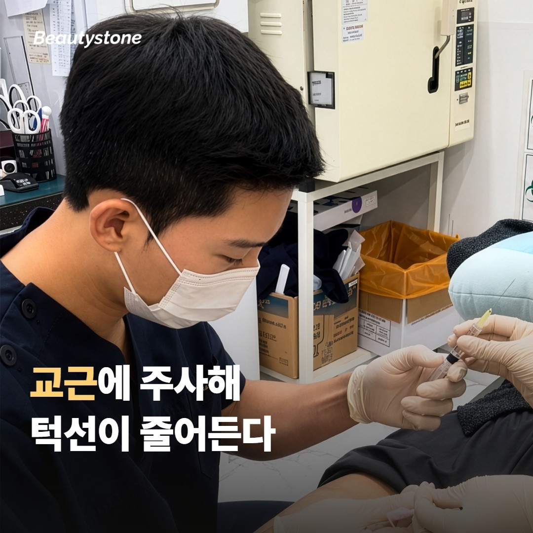 사각턱 보톡스 — 저작근에 작용한다