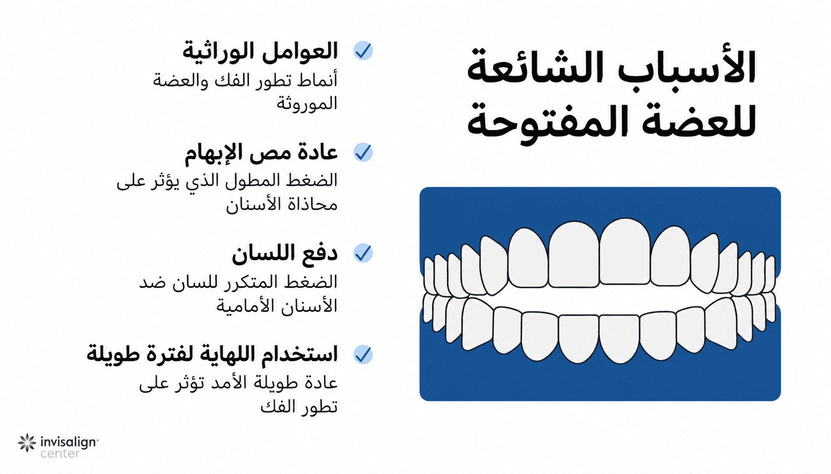 رسم توضيحي يستعرض أسباب العضة المفتوحة الشائعة، مثل عادة مص الإبهام ودفع اللسان للأمام