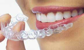 Invisalign treatment in coimbatore