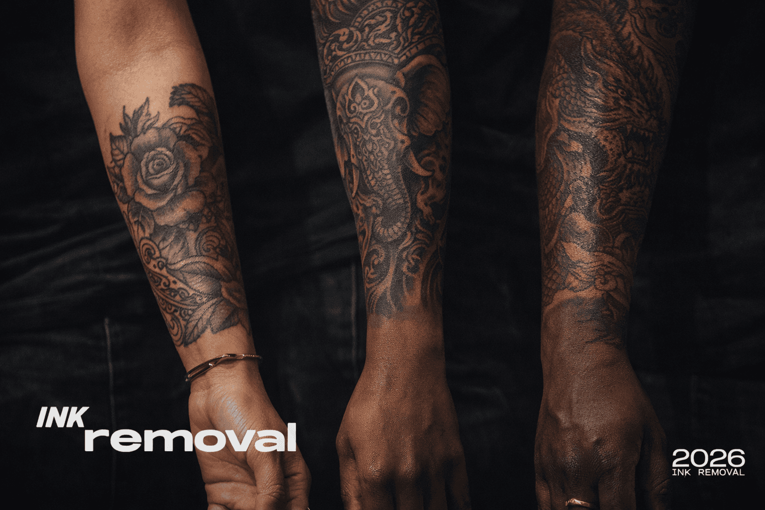 Three tattooed forearms showing showing different skin tones ranging from Fitzpatrick skin types 4, 5, and 6 for tattoo removal comparison.