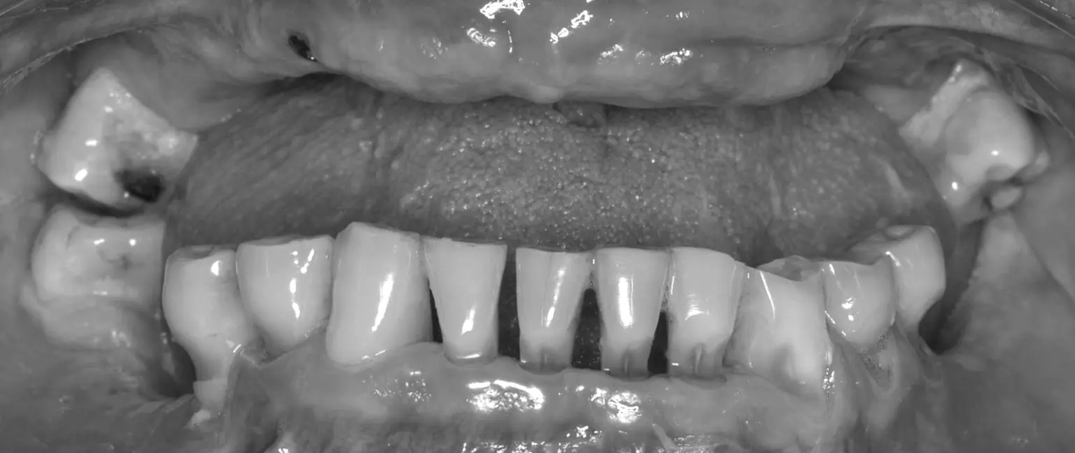 Examples of complex cases treated