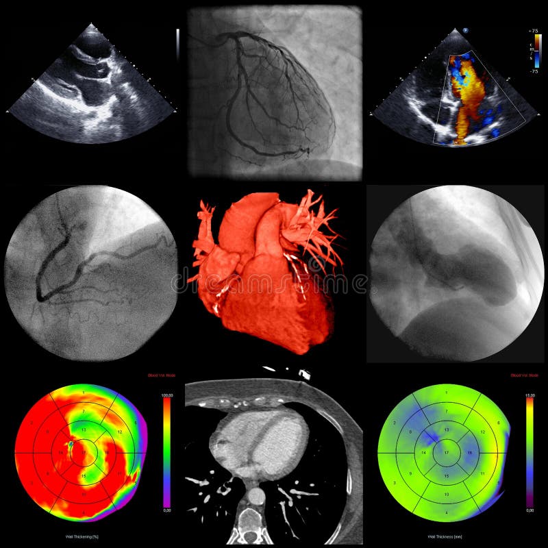 Cardiac imaging