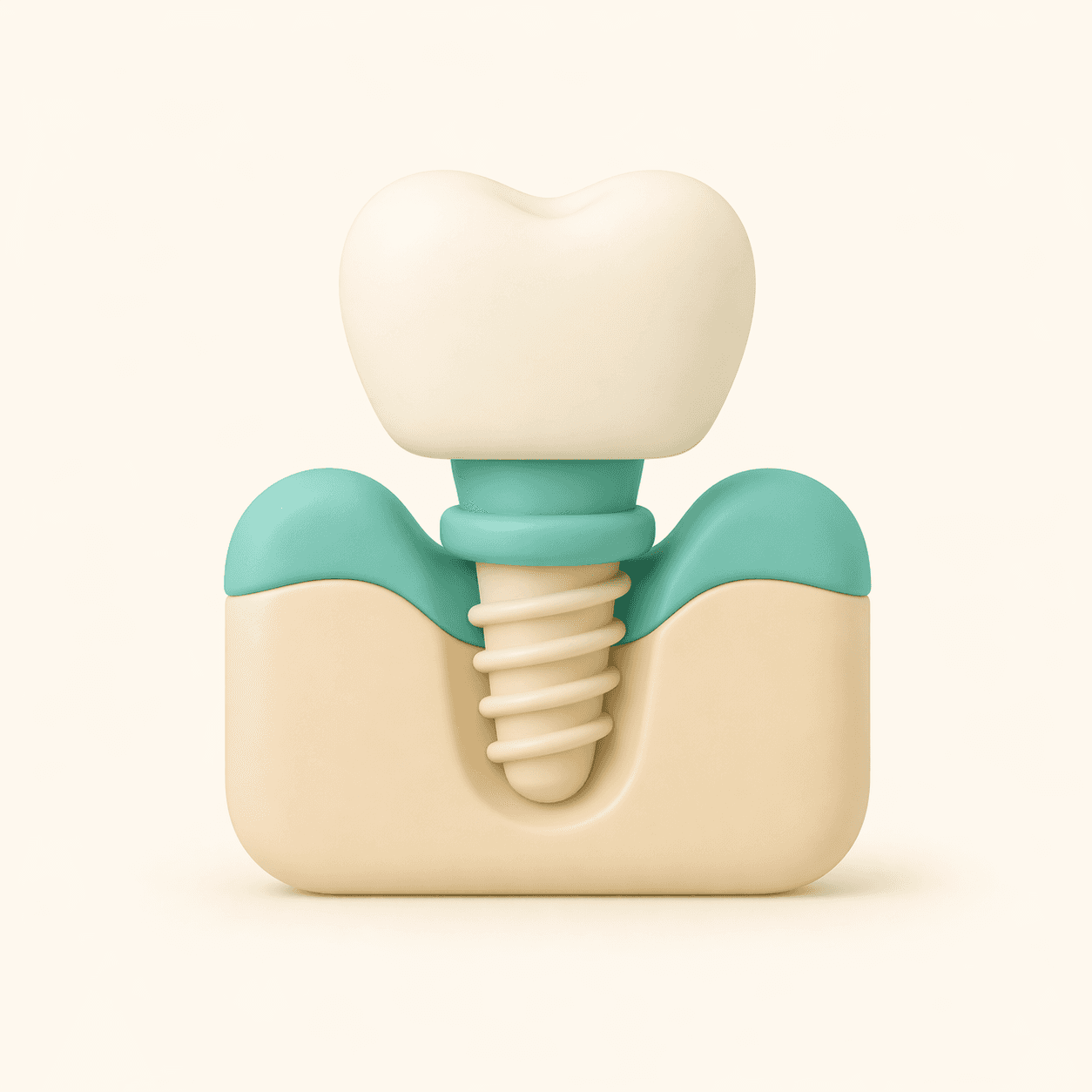 dental implant illustration