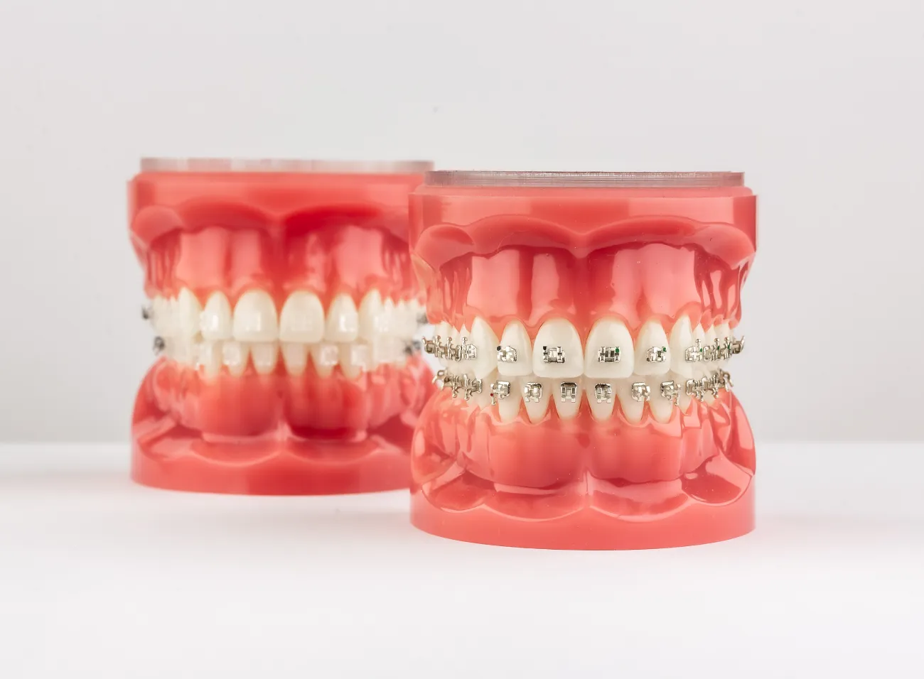 Lekarz prezentujący jak wyglądają nakładki.