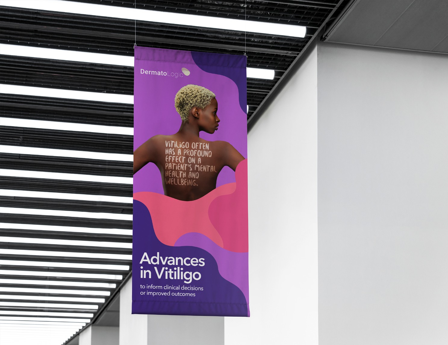 Vitiligone banner