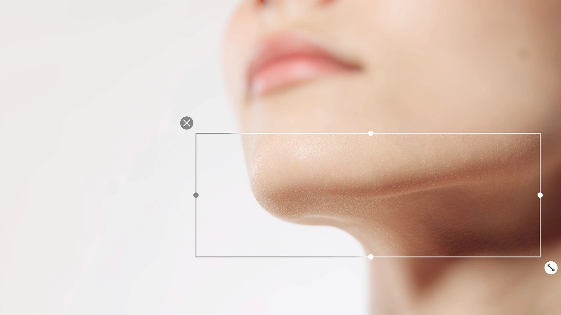 Doppelkinn-Korrektur