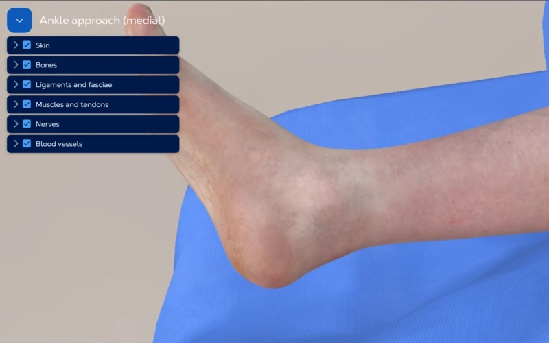 Ankle Approach - Medial