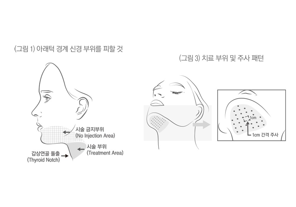 v-olet Proper injection location and dosage 
