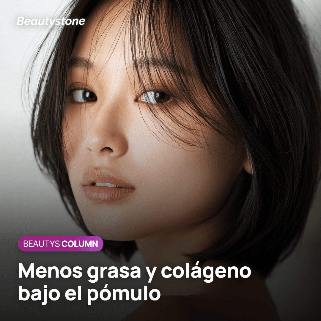 Zona bajo el pómulo con pérdida de grasa y colágeno en el tercio medio