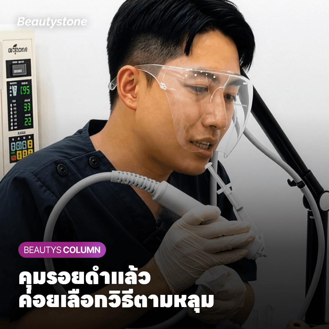 แพทย์ตรวจรูปร่างและความลึกของหลุมสิวเพื่อวางลำดับรักษาหลังคุมรอยดำ