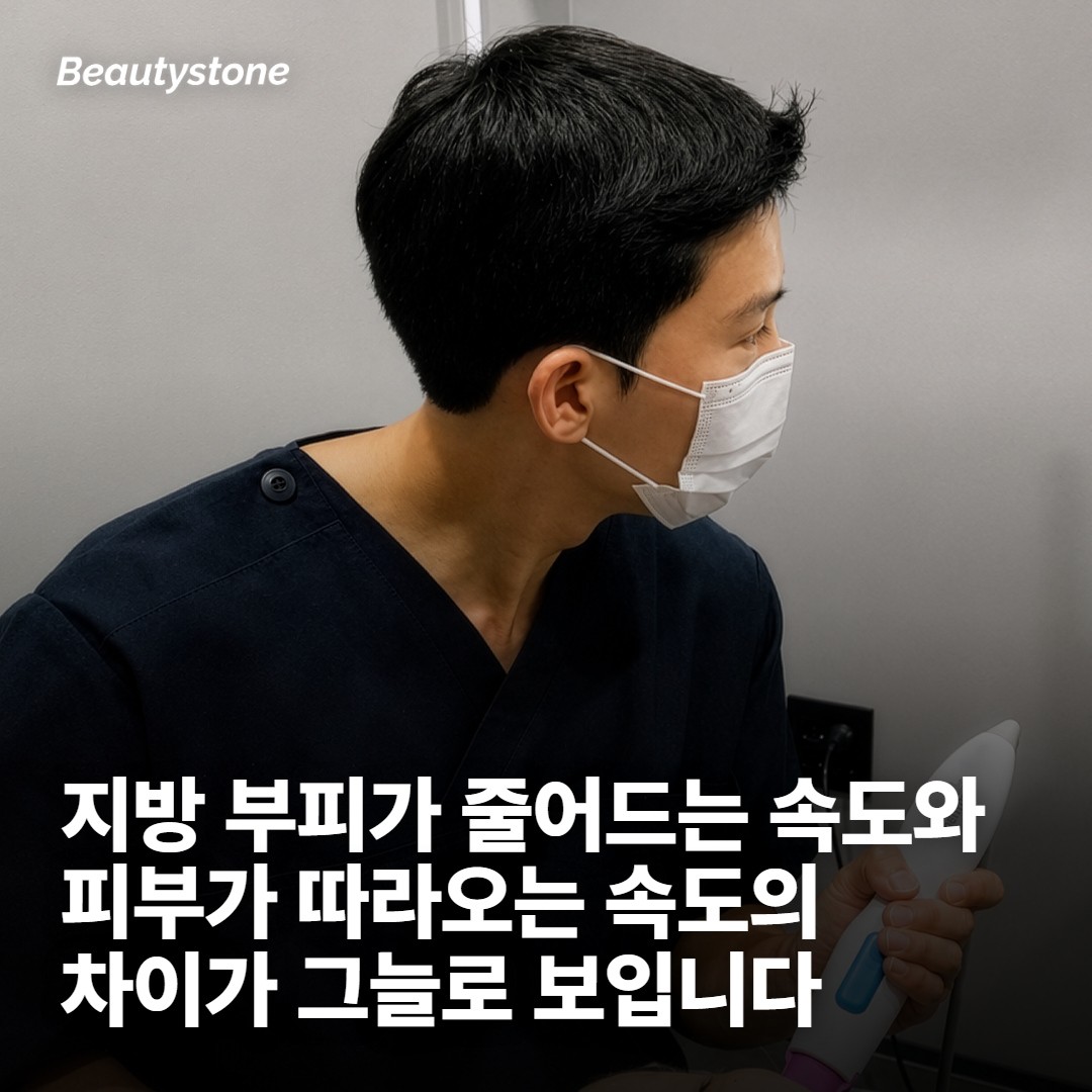 살이 빠지는 국면에서 얼굴이 먼저 티가 나는 이유