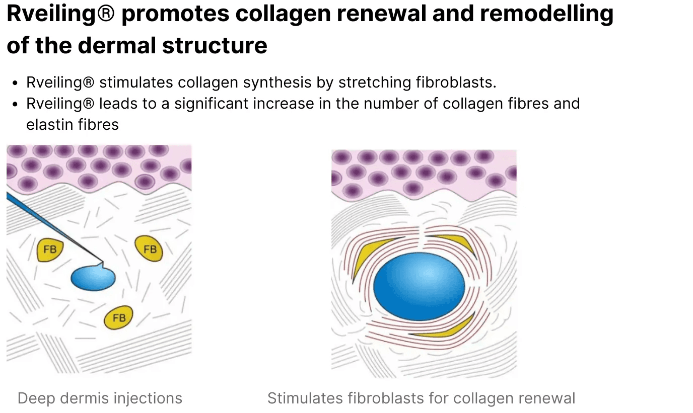 Rveiling® promotes collagen renewal and remodelling of the dermal structure