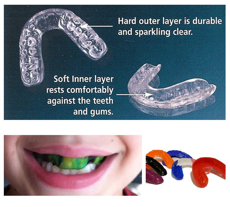 Child receiving topical fluoride treatment to strengthen teeth enamel at Dentistree Dental Clinic Kolkata