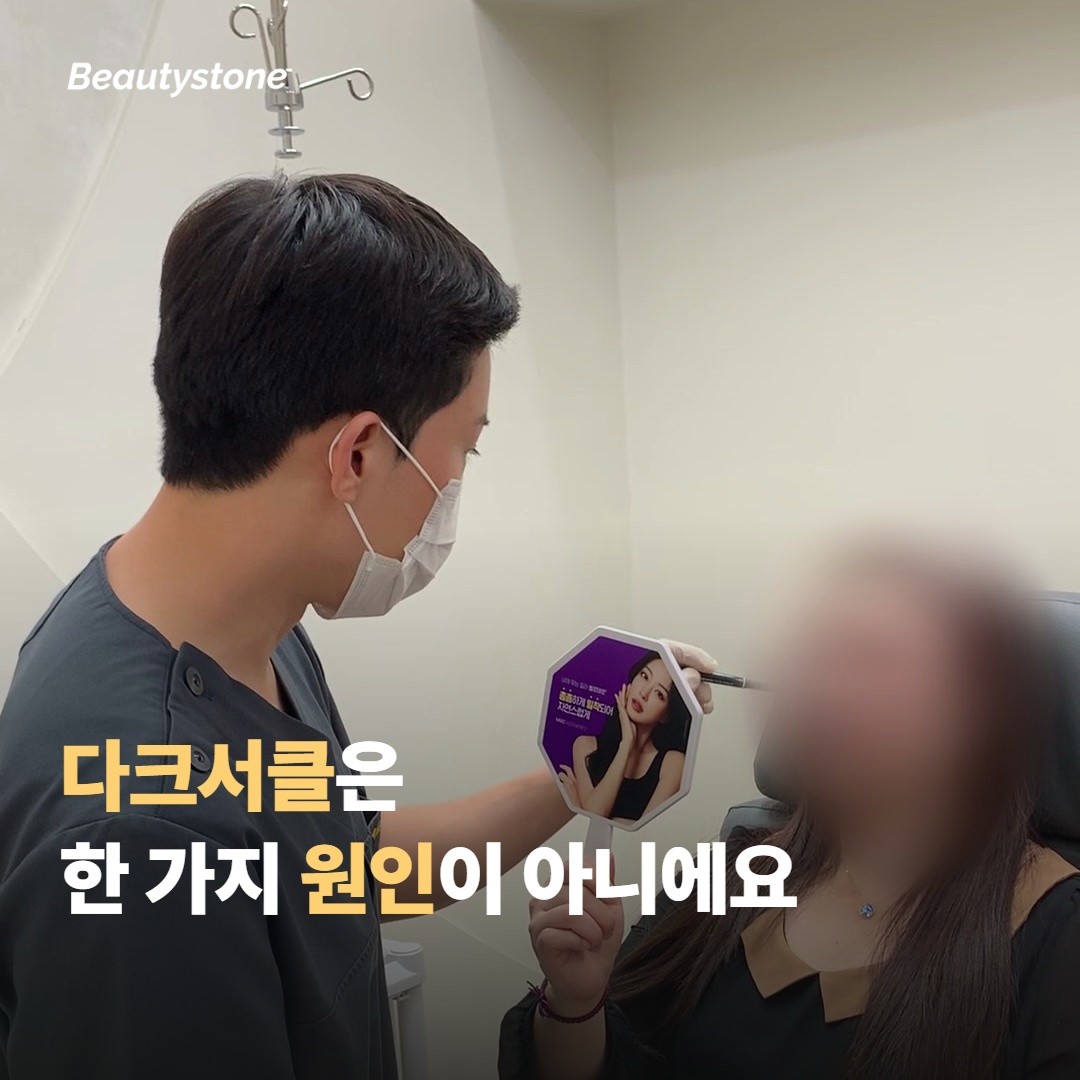 다크서클은 한 가지 원인이 아니에요