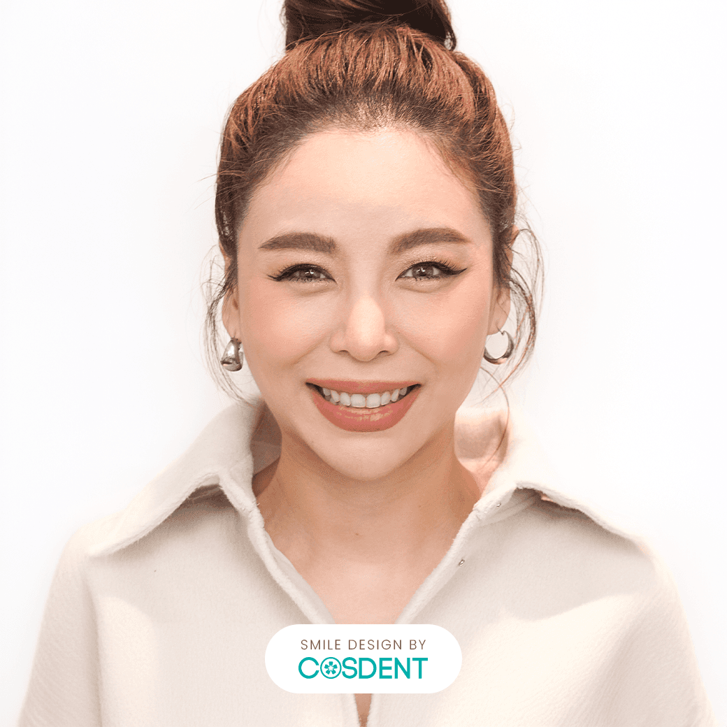 หน้าสามเหลี่ยม ยิ้มกว้าง 16 ซี่