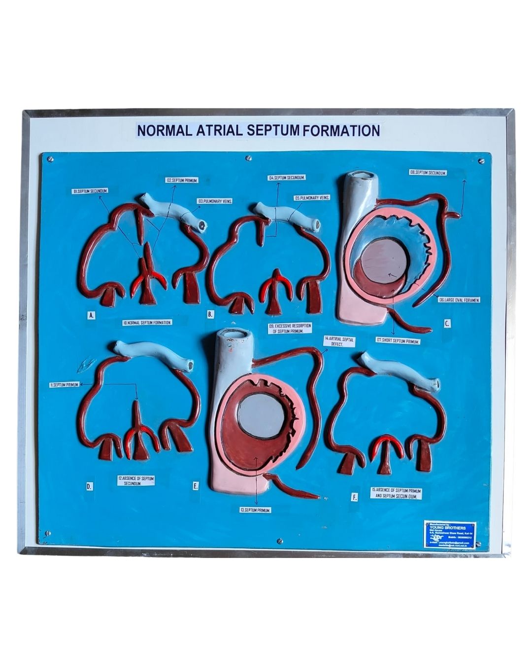 Normal Atrial Septum Formation
