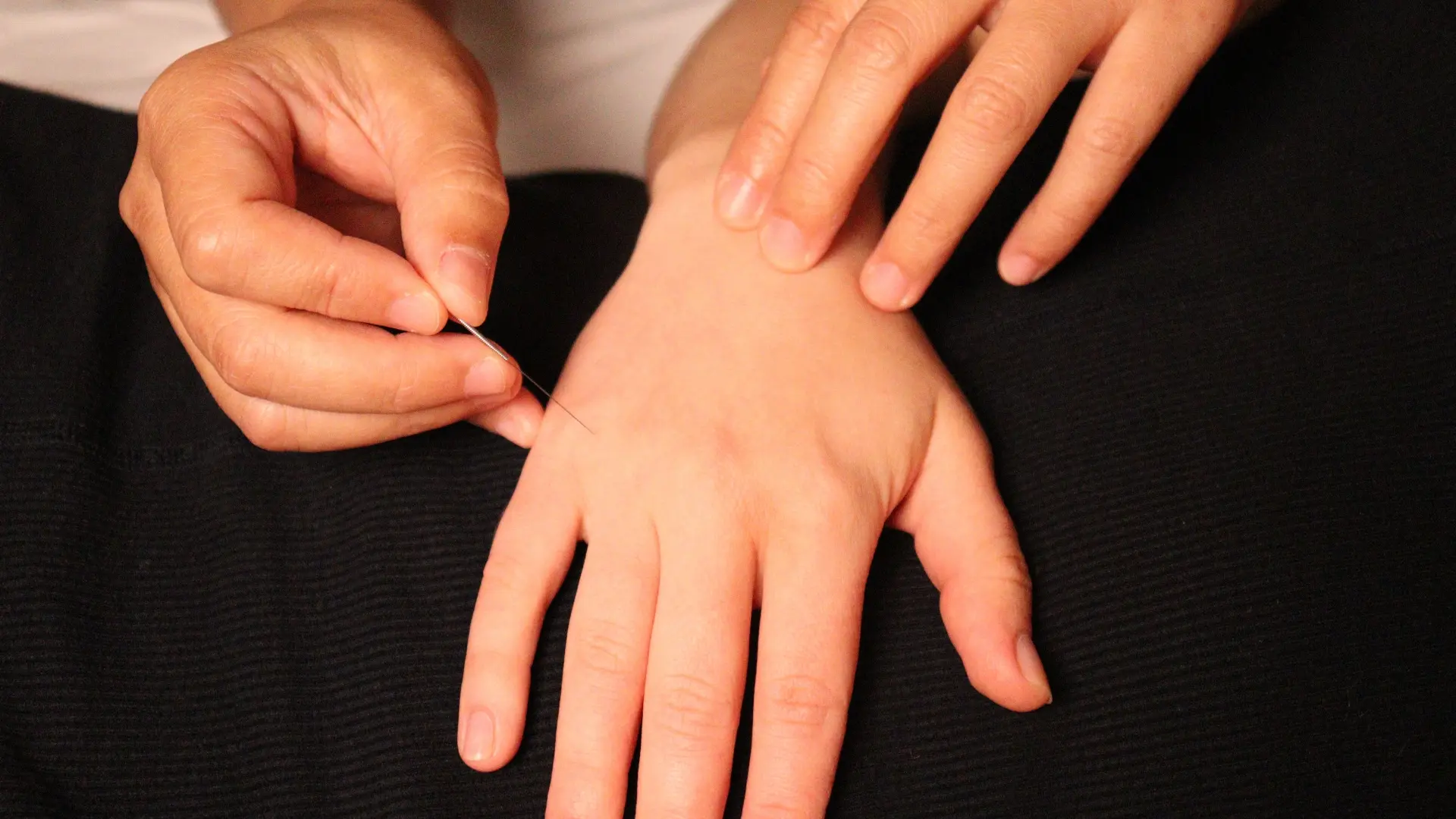 Practitoner placing an acupuncture needle in a hand.