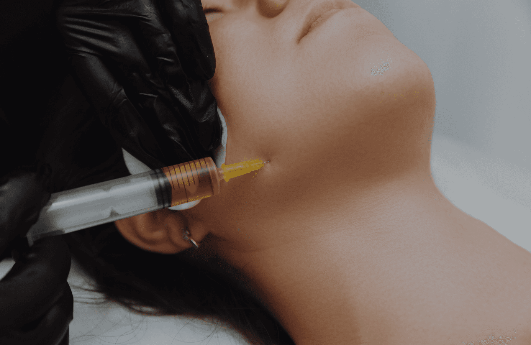 Woman relaxing before injectable or PRP treatment designed to smooth wrinkles, restore facial volume, and boost collagen naturally.