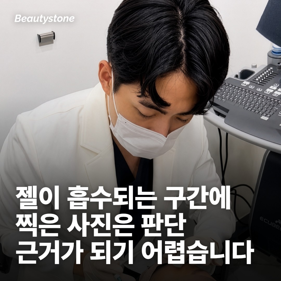 평가 시점이 이르면 없는 효과로 보입니다