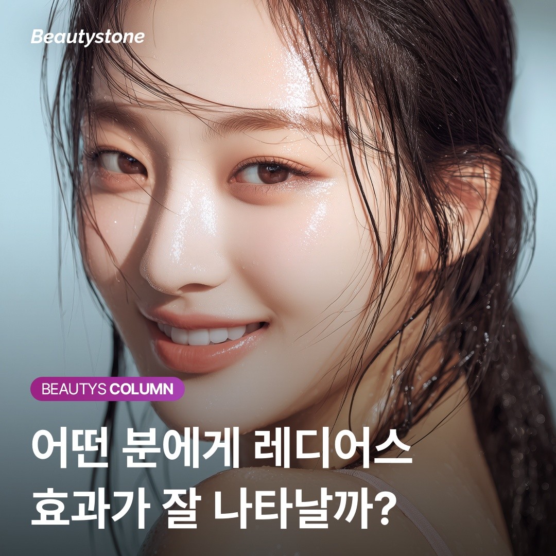 필러가 다 빠졌는데 왜 볼륨이 그대로죠? 레디어스가 남기고 간 진짜 선물