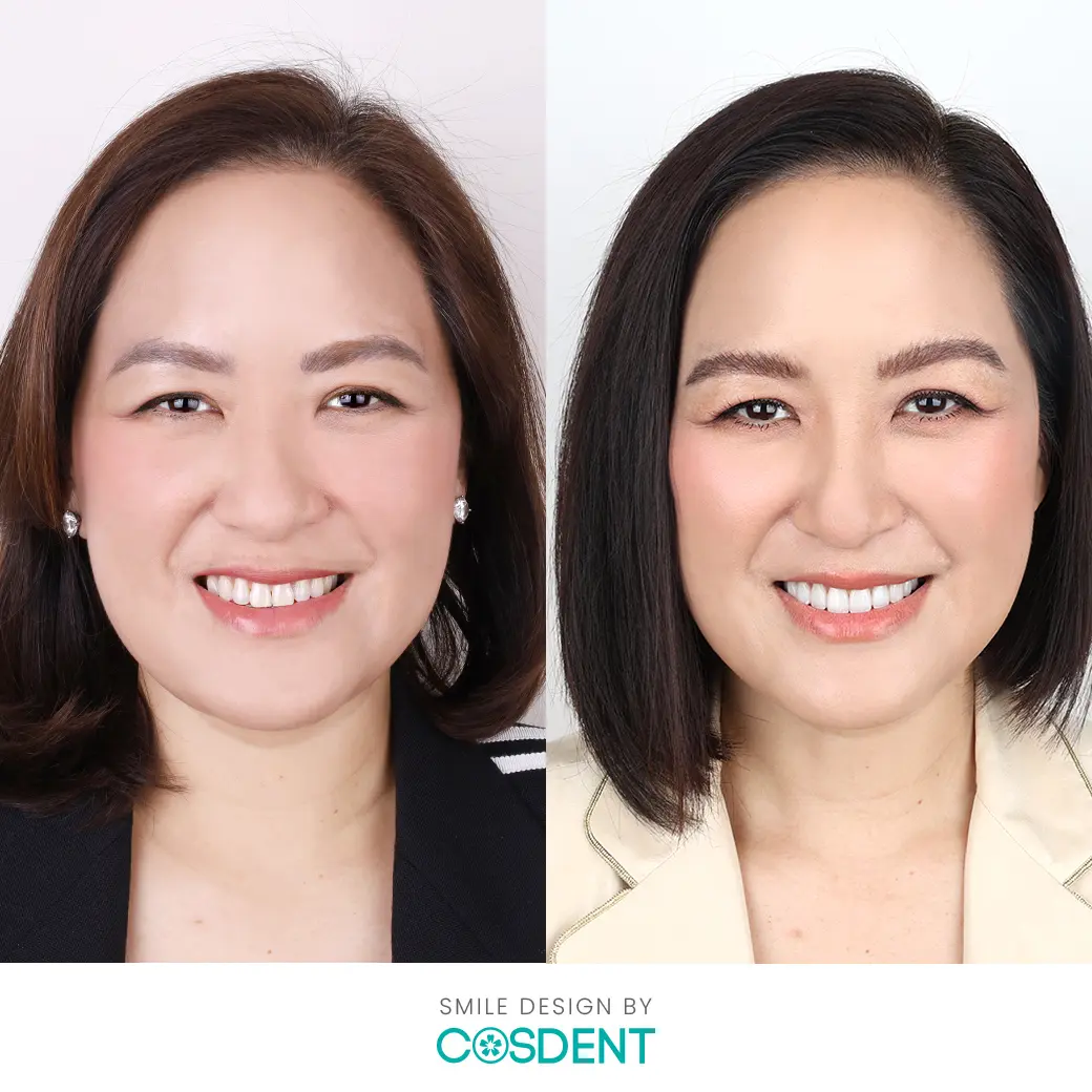 ผู้เชียวชาญแก้ไขทุกความกังวล รอยยิ้ม ที่ cosdent smile design