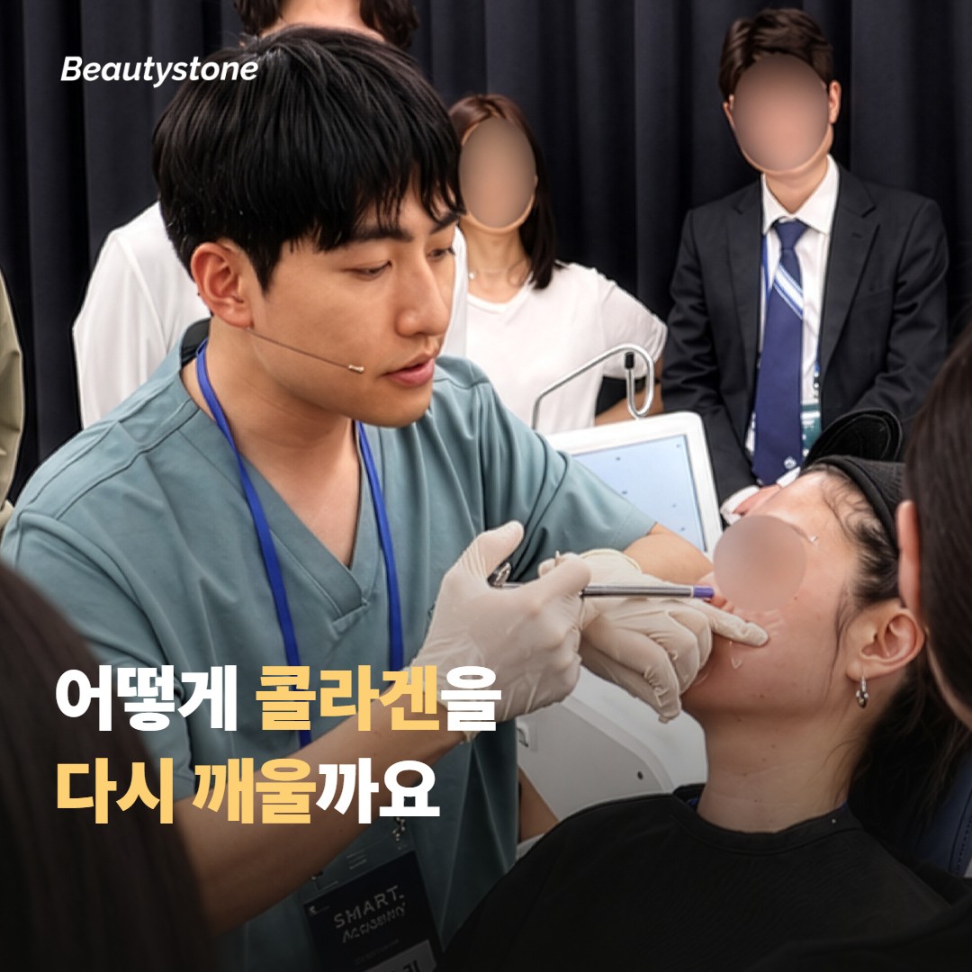 소프웨이브 vs 슈링크는 어떻게 콜라겐을 다시 깨울까요