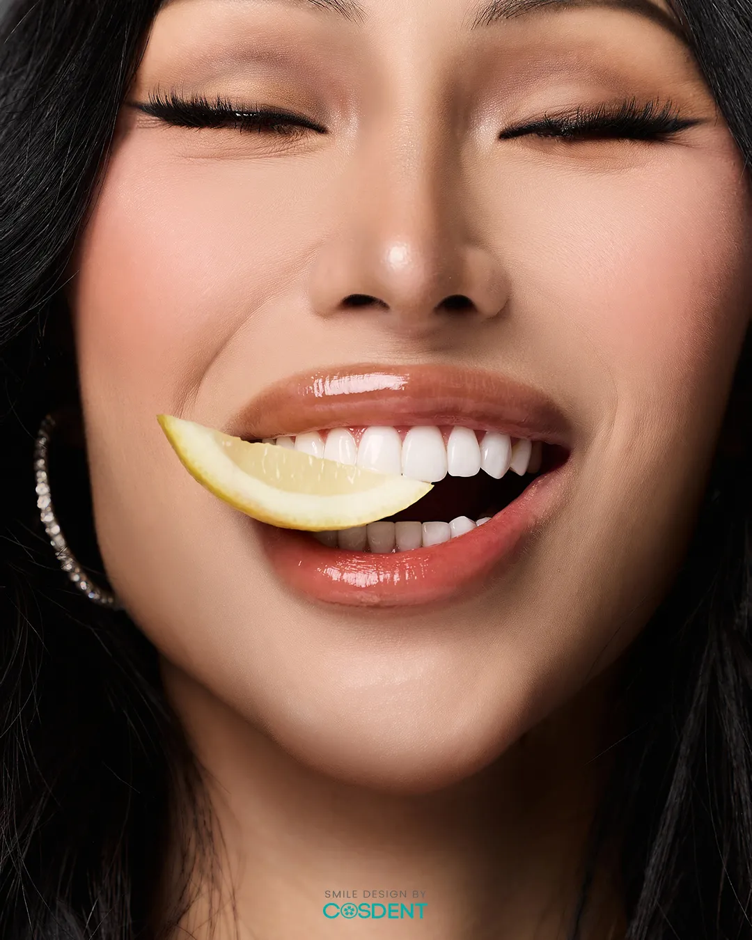ฟลุ๊ค กะล่อน คนไข้วีเนียร์ของ COSDENT Smile Design กรุงเทพฯ