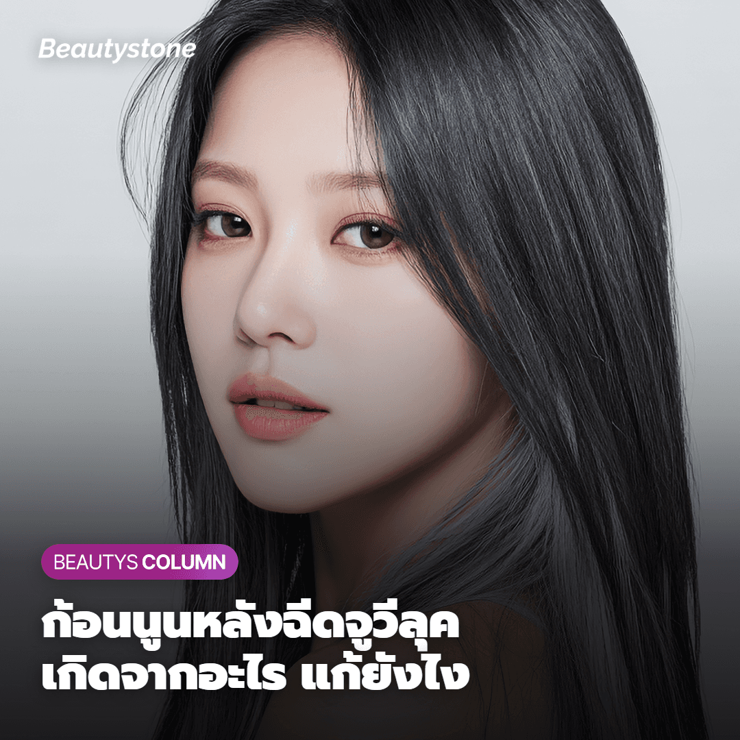 ความแตกต่างระหว่างจูเวลุคกับเรเดียสโดยหมอคิมกาอึล