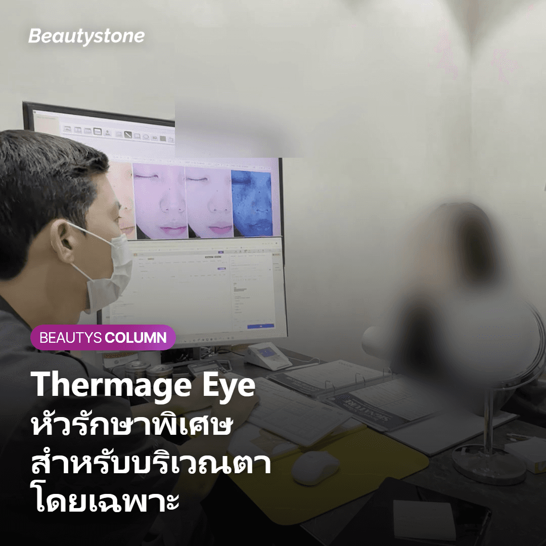 ภาพแสดงกลไก Thermage FLX กับหัวรักษาพิเศษสำหรับบริเวณตา