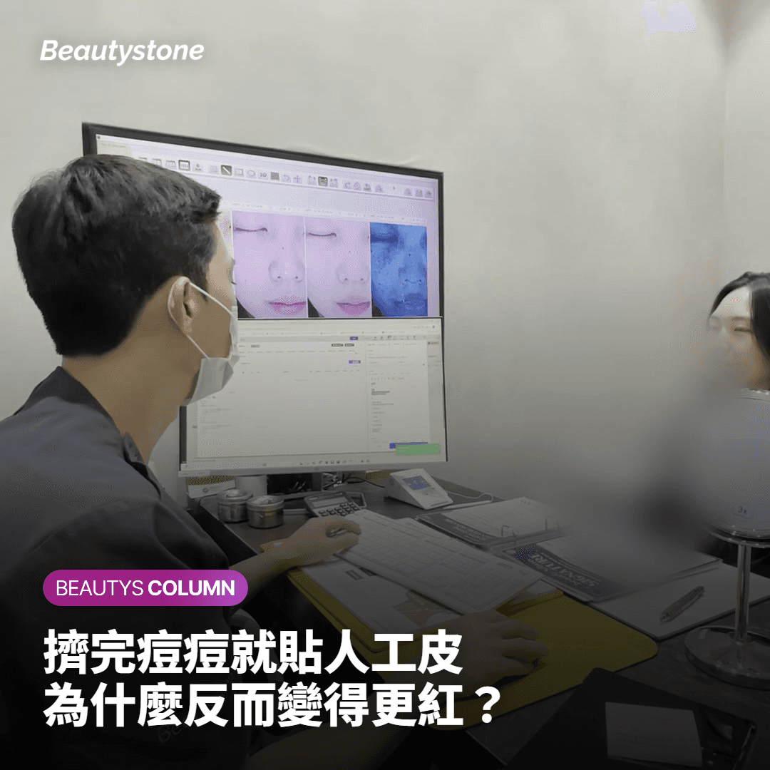 "擠完痘痘貼了多愛膚為什麼反而更紅？"醫生講述真正原因