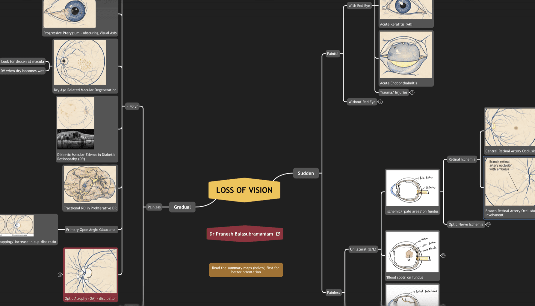 Xmind mind map by Dr. Pranesh Balasubramaniam showing illustrated diagnostic paths for vision loss, including sudden, gradual, painful, painless, and red-eye conditions.