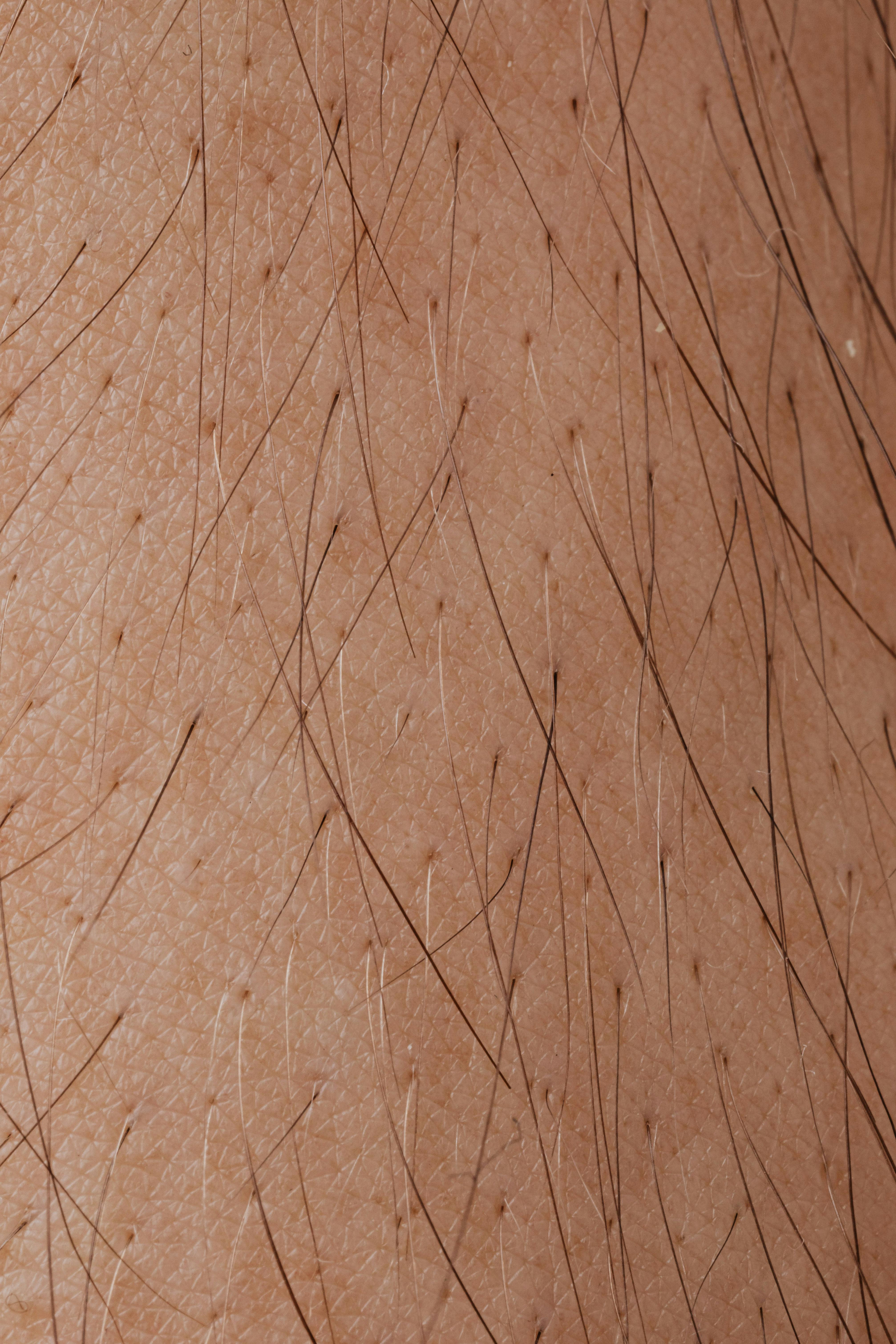 detailed-macro-image-showing-human-skin-texture-and-hair-follicles. - www.kaboompics.com (pexels)