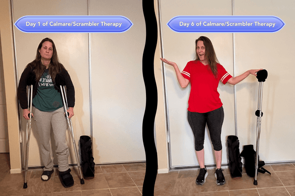 Image of What is Sandra doing and her journey from Day 1 to Day 6 showing her on crutches to the left and without crutches to the right