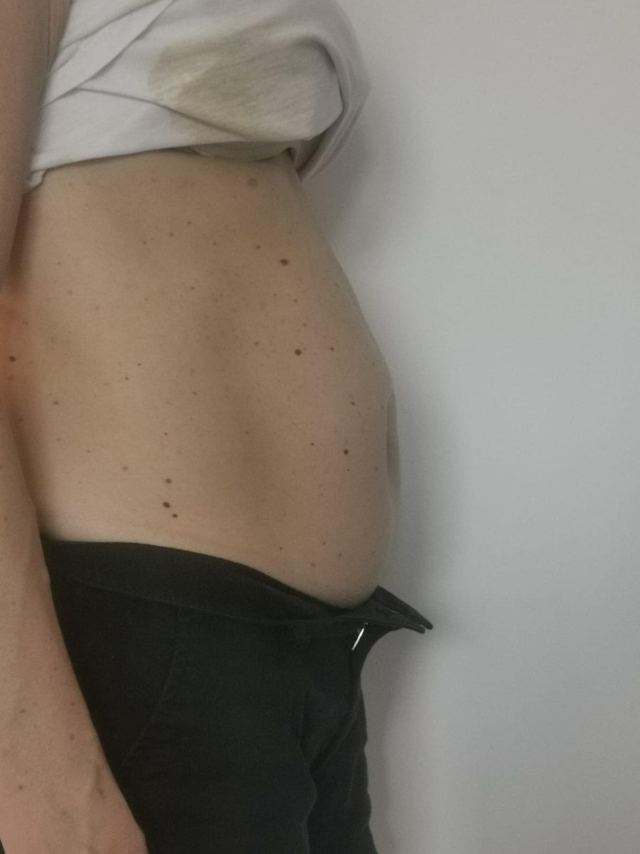 Debora prima del percorso, pancia di profilo