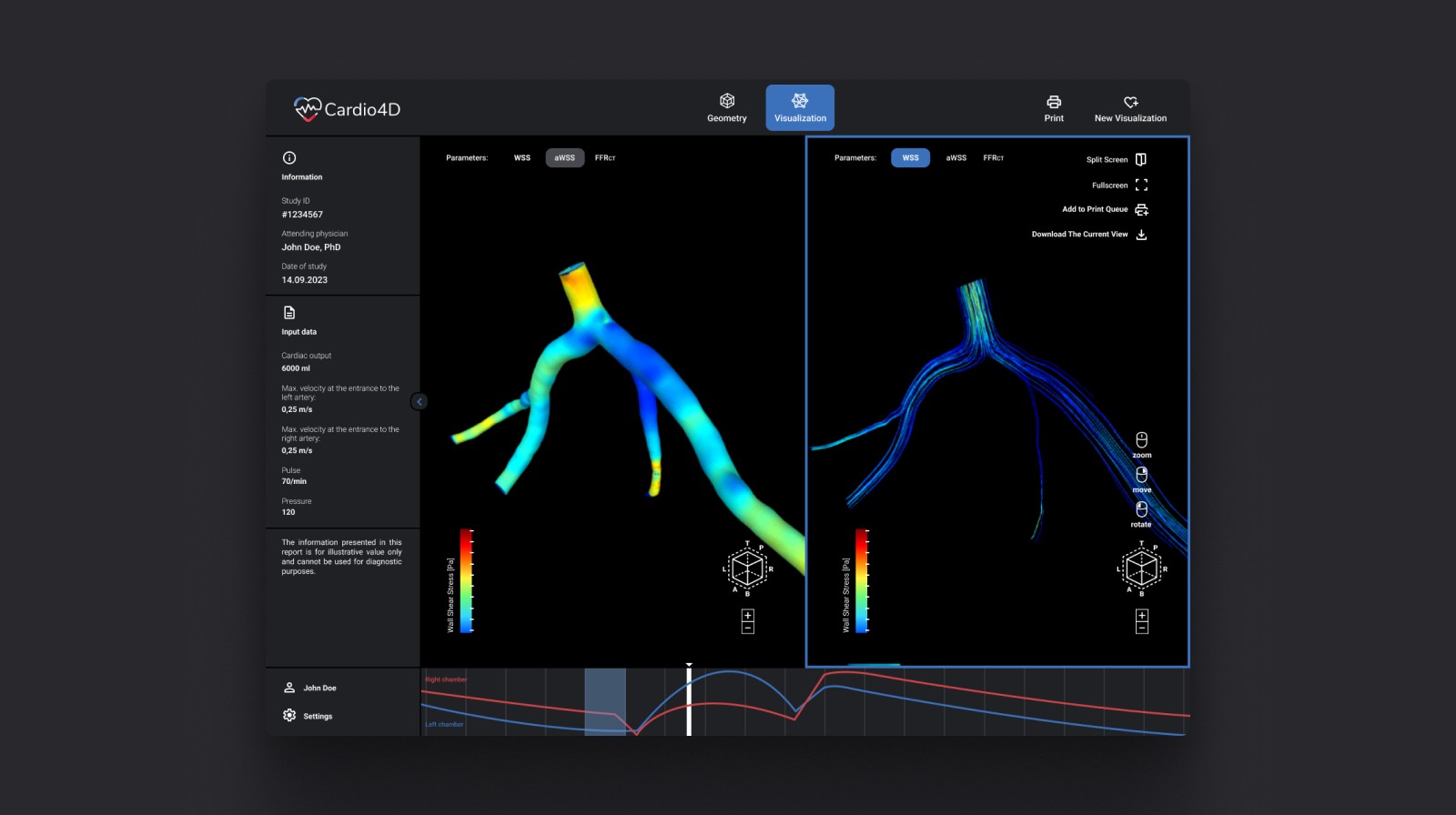 Laptop showing Bloomy UI