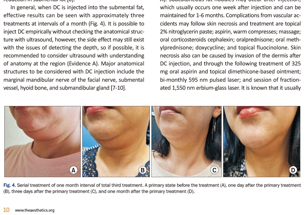 Clinical Guideline: Deoxycholic Acid Injection for Submental Fat Reduction