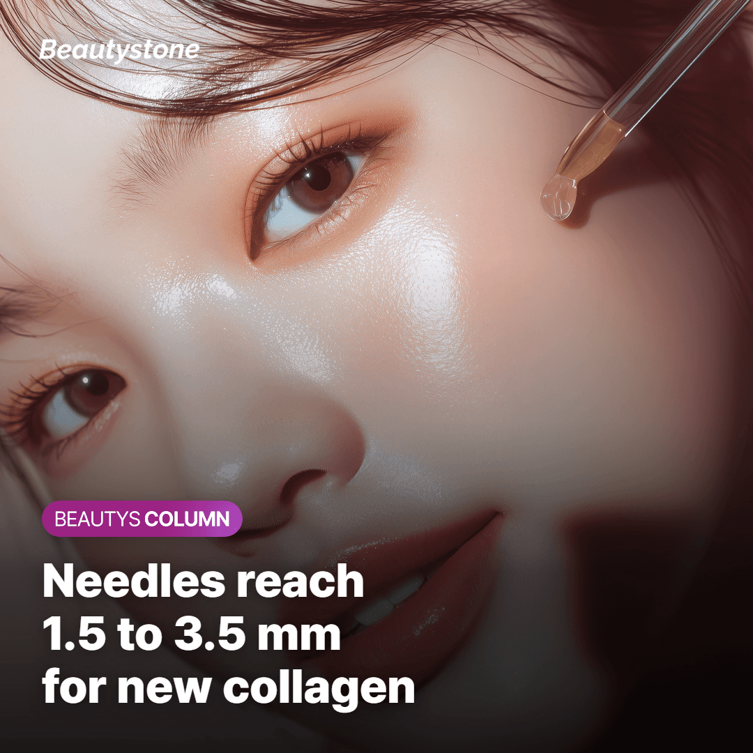 How Secret RF needle depth works on pores