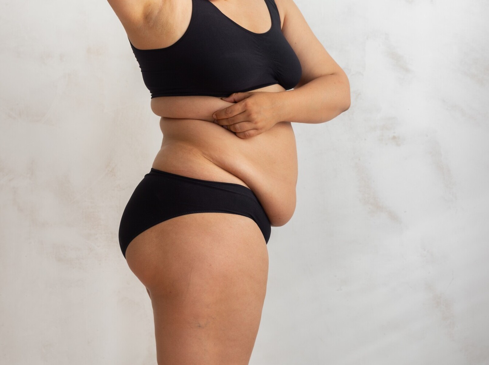 excess skin after weight loss