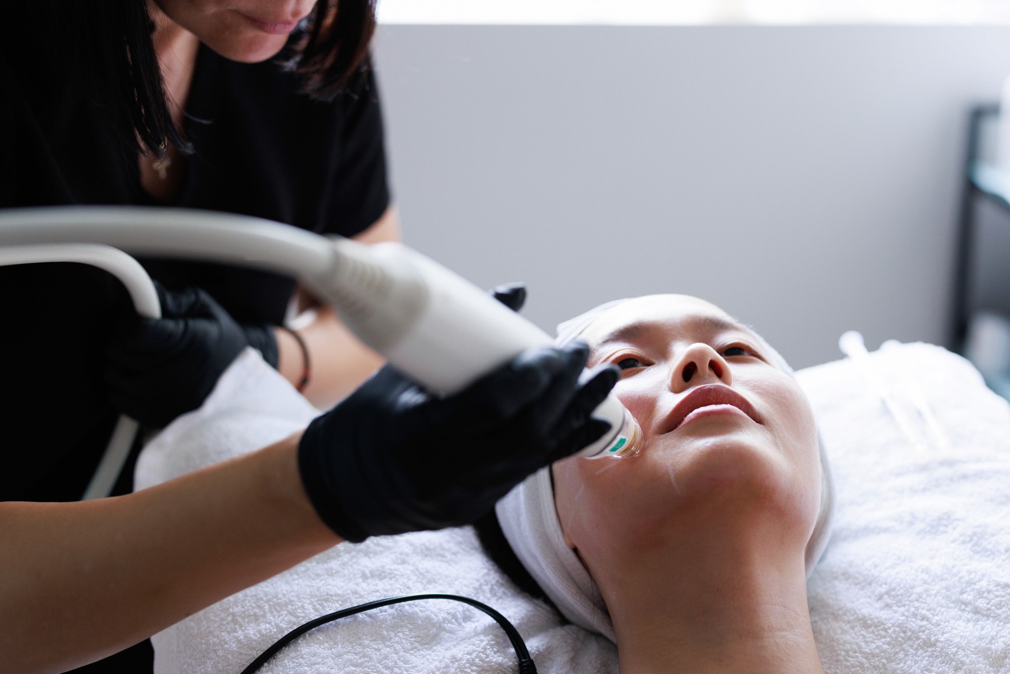 Patient receiving a microneedling treatment by our beautician