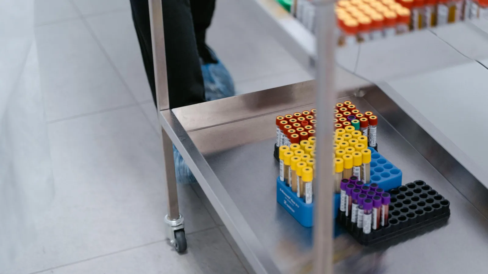 Is Bilirubin in Urine Normal?