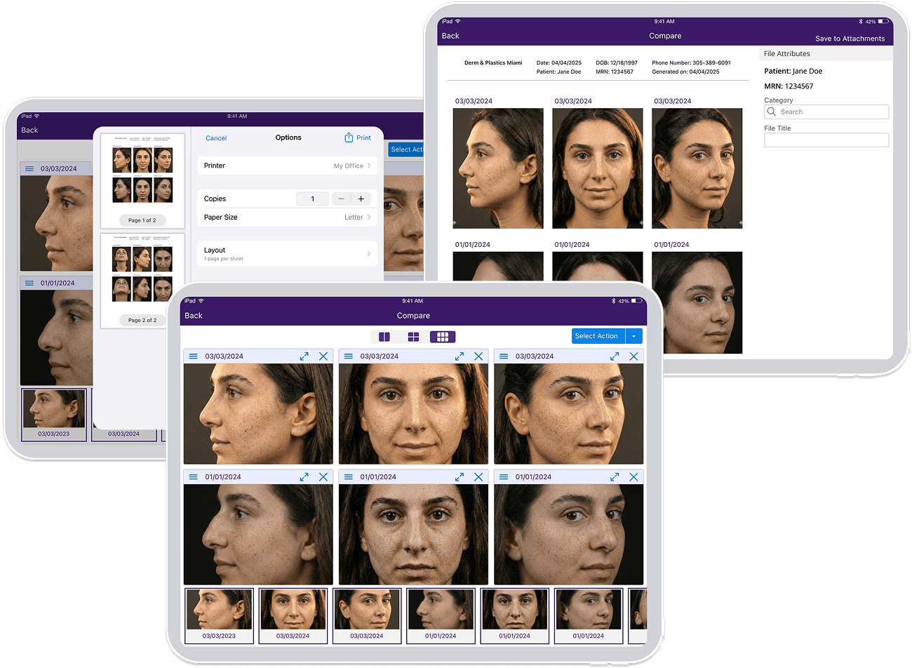 Collage of 3 ipads showing a photo gallery
