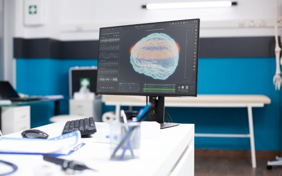 На екрані монітора сканування мозку