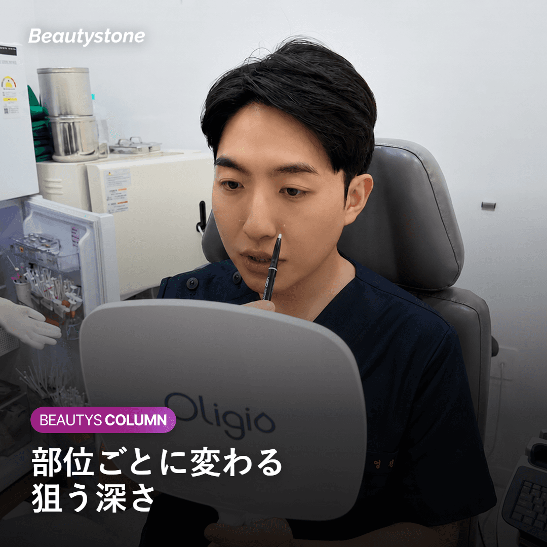 部位ごとに必要なショット数が変わる理由